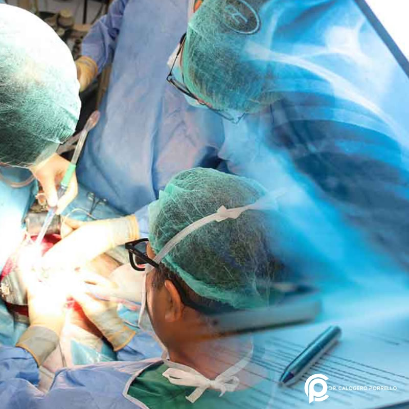 Quali sono le patologie trattate più spesso dal chirurgo toracico?